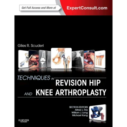 Techniques in Revision Hip and Knee Arthroplasty