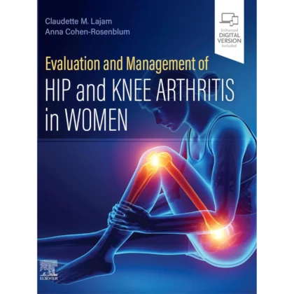 Evaluation and Management of Hip and Knee Arthritis in Women