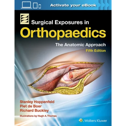 Surgical Exposures in Orthopaedics: The Anatomic Approach