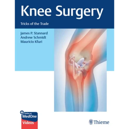 Knee as Surgery: Tricks of the Trade