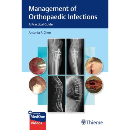 Management of Orthopaedic Infections: A Practical Guide