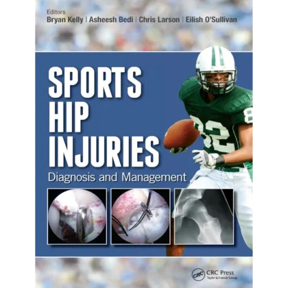 Sports Hip Injuries: Diagnosis and Management