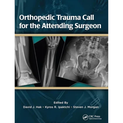 Orthopedic Trauma Call for the Attending Surgeon