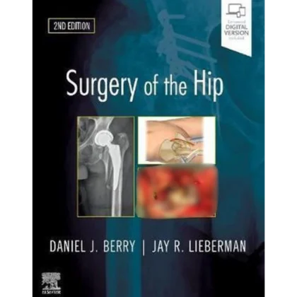 Surgery of the Hip