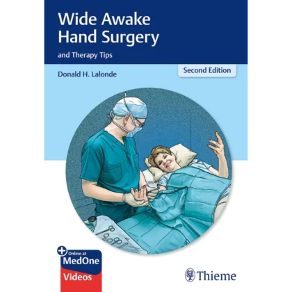 Wide Awake Hand Surgery and Therapy Tips