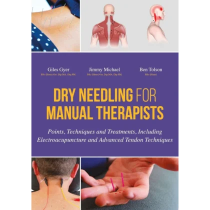 Dry Needling for Manual Therapists: Points, Techniques and Treatments, Including Electroacupuncture and Advanced Tendon Techniques