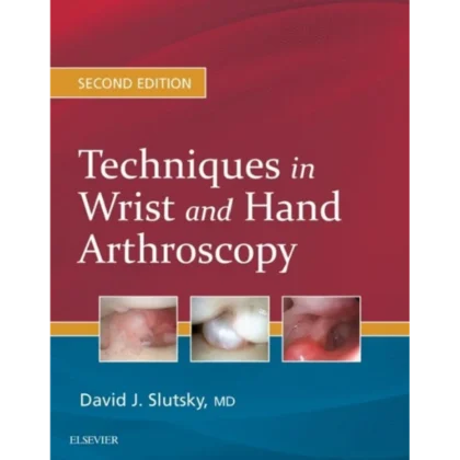 Techniques in Wrist and Hand Arthroscopy
