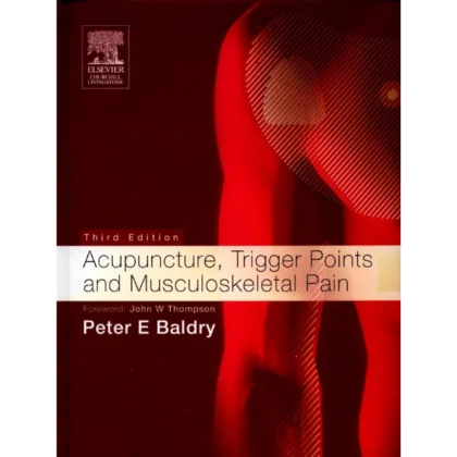 Acupuncture, Trigger Points and Musculoskeletal Pain