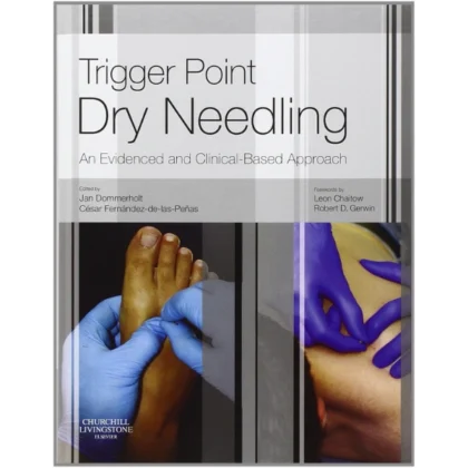 Trigger Point Dry Needling: An Evidence and Clinical-Based Approach
